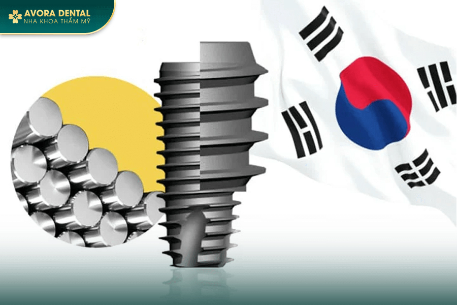 Top 4 Dòng Trụ Implant Hàn Quốc Chất Lượng Tốt Nhất Hiện Nay