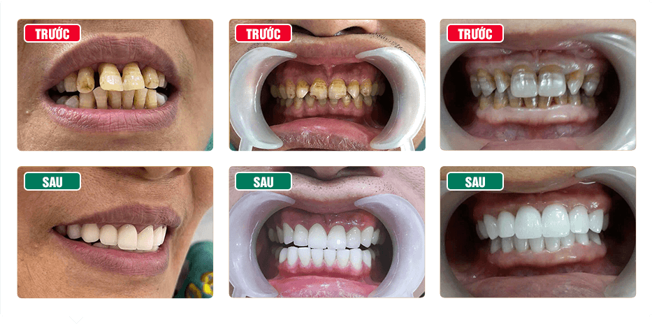 Nha Khoa Thẩm Mỹ Bác Sĩ Trung Hiếu