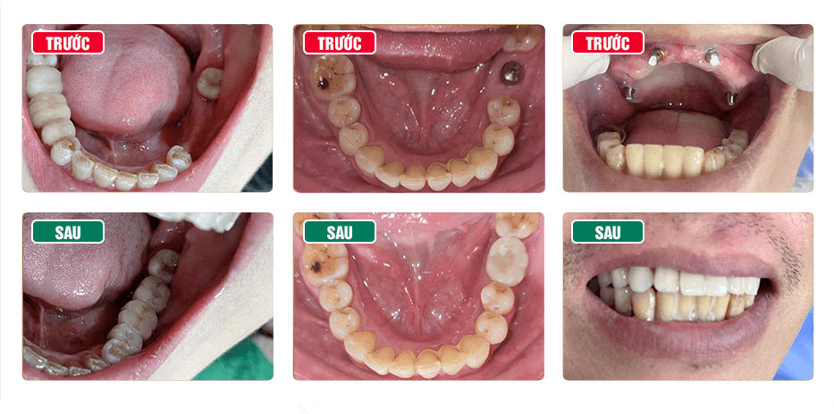 Nha Khoa Thẩm Mỹ Bác Sĩ Trung Hiếu