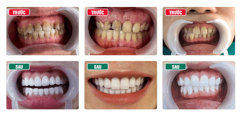 Nha Khoa Thẩm Mỹ Bác Sĩ Trung Hiếu